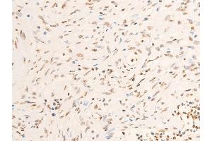 Immunohistochemistry (IHC) image for anti-Janus Kinase 1 (JAK1) (pTyr1022), (pTyr1023) antibody (ABIN6255762)
