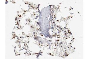 ABIN6266478 at 1/200 staining human Bone marrow tissue sections by IHC-P. (CEBPE Antikörper  (Internal Region))
