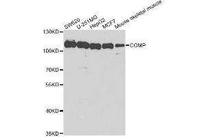 Western blot analysis of extracts of various cell lines, using COMP antibody. (COMP Antikörper  (AA 20-160))