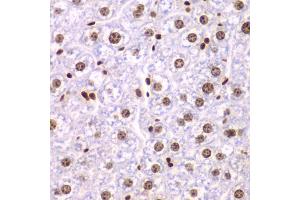 Immunohistochemistry of paraffin-embedded mouse liver using SSRP1 antibody (ABIN5973814) at dilution of 1/200 (40x lens). (SSRP1 Antikörper)
