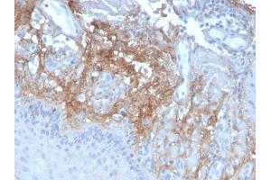 Formalin-fixed, paraffin-embedded human Skin stained with Decorin Mouse Monoclonal Antibody (DCN/3523). (Decorin Antikörper  (AA 212-336))