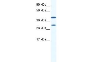 WB Suggested Anti-GJA1 Antibody Titration:  0.