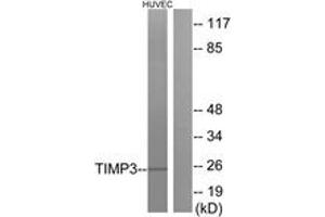 Western blot analysis of extracts from HuvEc cells, using TIMP3 Antibody. (TIMP3 Antikörper  (AA 91-140))