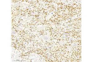 Immunohistochemistry analysis of paraffin-embedded rat spinal cord using,KCC2 (ABIN7075650) at dilution of 1: 1800 (KCC2 Antikörper)