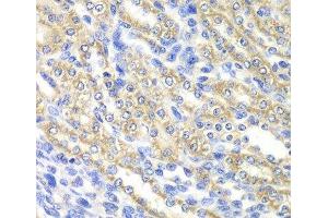 Immunohistochemistry of paraffin-embedded Rat kidney using SURF1 Polyclonal Antibody at dilution of 1:100 (40x lens). (SURF1 Antikörper)