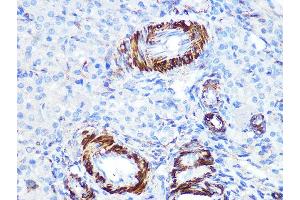 Immunohistochemistry of paraffin-embedded rat ovary using Caldesmon Rabbit mAb (ABIN7266024) at dilution of 1:100 (40x lens). (Caldesmon Antikörper)