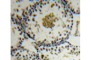 Used in DAB staining on fromalin fixed paraffin-embedded Testis tissue