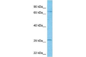 Host:  Rabbit  Target Name:  FOXR2  Sample Type:  U937 Whole Cell lysates  Antibody Dilution:  1. (FOXR2 Antikörper  (Middle Region))