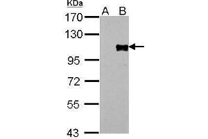 WB Image FOXM1 antibody detects FOXM1 protein by Western blot analysis. (FOXM1 Antikörper)