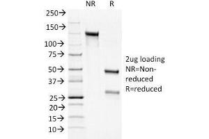 SDS-PAGE Analysis of Purified, BSA-Free Bcl2 Antibody cocktail (100/D5 + 124). (Bcl-2 Antikörper  (AA 41-54))