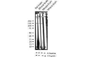 Western blot analysis of Phospho-ASK1 (Ser966) expression in various lysates (ASK1 Antikörper  (pSer966))