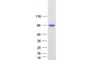 Western Blotting (WB) image for CoA Synthase (COASY) (Transcript Variant 2) protein (Myc-DYKDDDDK Tag) (ABIN2712922)