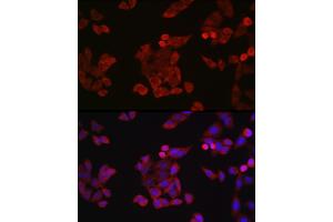 Immunofluorescence analysis of HeLa cells using Cyclin B1 Rabbit pAb (ABIN3022806, ABIN3022807, ABIN3022808 and ABIN6219237) at dilution of 1:150 (40x lens). (Cyclin B1 Antikörper  (C-Term))