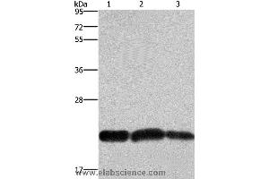 Western blot analysis of A375 and Raji cell, human fetal brain tissue, using CBX3 Polyclonal Antibody at dilution of 1:600 (CBX3 Antikörper)