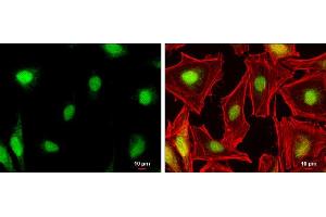 ICC/IF Image NR0B1 antibody detects NR0B1 protein at nucleus by immunofluorescent analysis. (NR0B1 Antikörper)