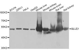 Western blot analysis of extracts of various cell lines, using GLUD1 antibody (ABIN5975614) at 1/1000 dilution. (GLUD1 Antikörper)