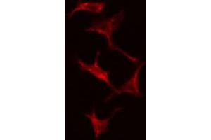 ABIN6274824 staining Hela cells by IF/ICC. (ADH7 Antikörper  (Internal Region))