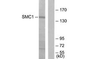 Western blot analysis of extracts from 293 cells, treated with UV 15', using SMC1 (Ab-957) Antibody. (SMC1A Antikörper  (AA 931-980))