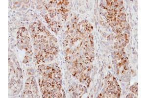 IHC-P Image Immunohistochemical analysis of paraffin-embedded A549 xenograft, using ECT2, antibody at 1:100 dilution. (ECT2 Antikörper  (N-Term))