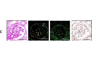 Immunofluorescence (Paraffin-embedded Sections) (IF (p)) image for anti-Ataxia Telangiectasia Mutated (ATM) (AA 1974-1988), (pSer1981) antibody (ABIN6656104)