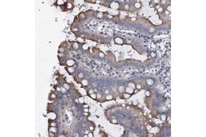 Immunohistochemical staining of human small intestine with PRHOXNB polyclonal antibody  shows moderate cytoplasmic positivity in glandular cells at 1:500-1:1000 dilution.