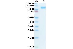 SDS-PAGE (SDS) image for CUB Domain Containing Protein 1 (CDCP1) (AA 25-667) protein (His-Avi Tag,Biotin) (ABIN7274297)