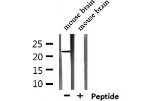 Western blot analysis of extracts from mouse brain, using TCEAL5 Antibody. (TCEAL5 Antikörper  (Internal Region))