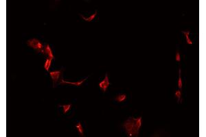 ABIN6266983 staining MCF-7 cells by IF/ICC. (MAST4 Antikörper  (N-Term))