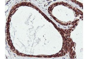 Immunohistochemical staining of paraffin-embedded Human breast tissue using anti-RNPEP mouse monoclonal antibody. (RNPEP Antikörper)