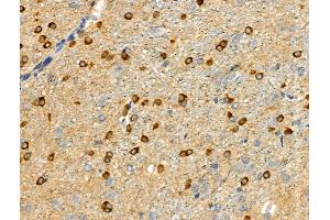 Phospho-MKK7 (Ser271) Antibody at 1/100 staining Rat brain tissue by IHC-P.