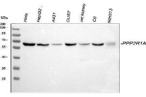 Western blot analysis of PPP2R1A using anti-PPP2R1A antibody (ABIN7603081).