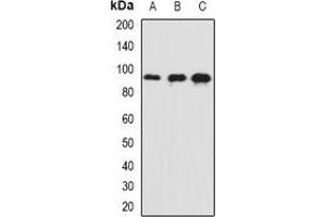 Western blot analysis of AP180 expression in mouse brain (A), mouse eye (B), rat brain (C) whole cell lysates. (SNAP91 Antikörper)