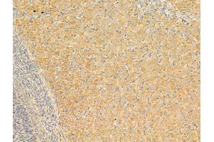 ABIN6255370 and ABIN6267631 at 1/100 staining Rat ovary tissue by IHC-P.