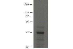 Image no. 1 for anti-Solute Carrier Family 9 (Sodium/hydrogen Exchanger), Member 3 Regulator 2 (SLC9A3R2) antibody (ABIN1169696) (SLC9A3R2 Antikörper)