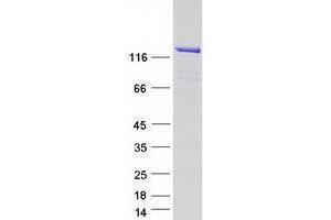 Western Blotting (WB) image for Ubiquitin Specific Peptidase 8 (USP8) (Transcript Variant 3) protein (Myc-DYKDDDDK Tag) (ABIN2734893)