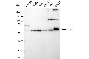 Western blotting analysis using TOE1 antibody (ABIN7800513).