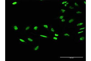 Immunofluorescence of purified MaxPab antibody to GTF2E1 on HeLa cell. (GTF2E1 Antikörper  (AA 1-439))