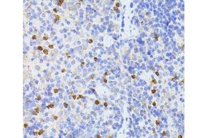 Immunohistochemistry of paraffin-embedded Mouse spleen using SMAD2 Polyclonal Antibody at dilution of 1:100 (40x lens). (SMAD2 Antikörper)