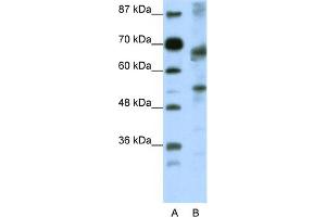 WB Suggested Anti-TCF12 Antibody Titration:  0. (TCF12 Antikörper  (N-Term))