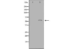 ACOT2 Antikörper  (Internal Region)