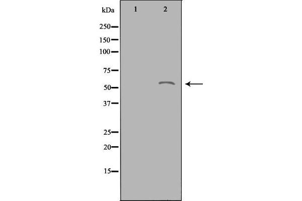 ACOT2 Antikörper  (Internal Region)