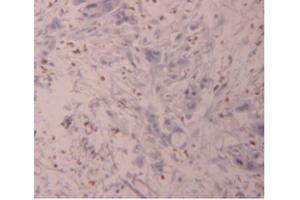 IHC-P analysis of Human Pancreas Tissue, with DAB staining. (FLG2 Antikörper  (AA 1222-1368))