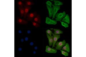 Phospho-Progesterone Receptor (Ser190) Antibody staining Hela cells(heat shock treatment) by IF/ICC.