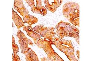 anti-Multi Cytokeratin 4/5/6/8/10/13/18 antibody