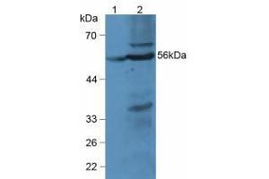 Western blot analysis of (1) Rat Liver Tissue and (2) Mouse Liver Tissue. (LPCAT3 Antikörper  (AA 122-233))
