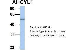 Host: Rabbit Target Name: AHCYL1 Sample Type: Human Fetal Liver Antibody Dilution: 1. (AHCYL1 Antikörper  (N-Term))