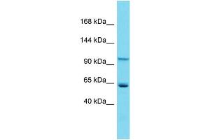 Host:  Rabbit  Target Name:  Zhx2  Sample Type:  Mouse Heart lysates  Antibody Dilution:  1. (ZHX2 Antikörper  (C-Term))