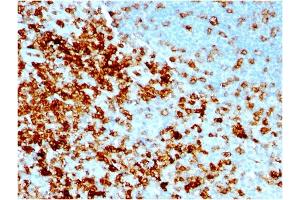Formalin-fixed, paraffin-embedded human Tonsil stained with CD43 Mouse Recombinant Monoclonal Antibody (rSPN/1094). (Rekombinanter CD43 Antikörper)