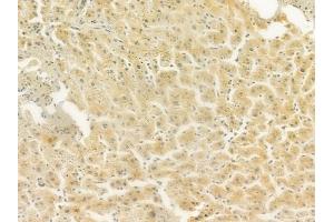 ABIN6265753 and ABIN6277726 at 1/100 staining human normal liver tissue by IHC-P.