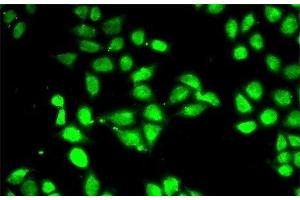 Immunofluorescence analysis of MCF-7 cells using PSMC3 Polyclonal Antibody (PSMC3 Antikörper)